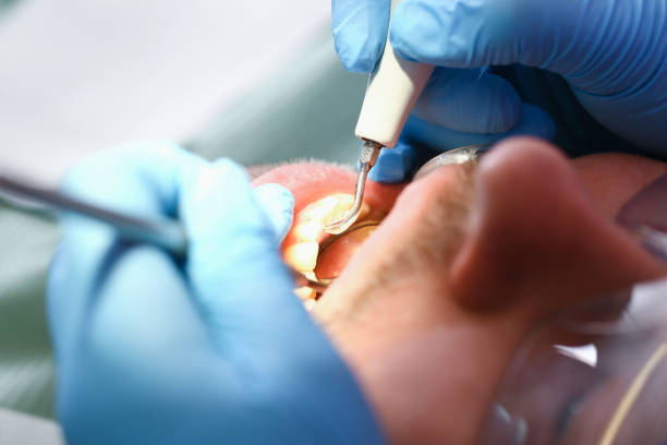 Best Broken or Cracked Tooth Emergency Dentist in Monongahela, PA